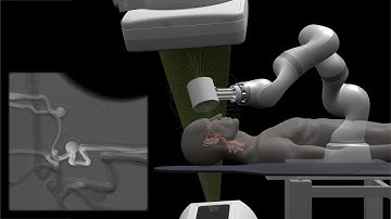 [Telerobotic Stroke Intervention] Summary Video