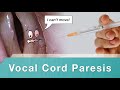 Injection Medialization for Vocal Cord Paresis