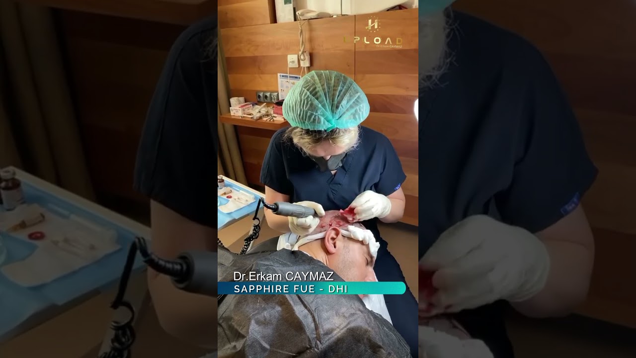 Hair Transplant Process