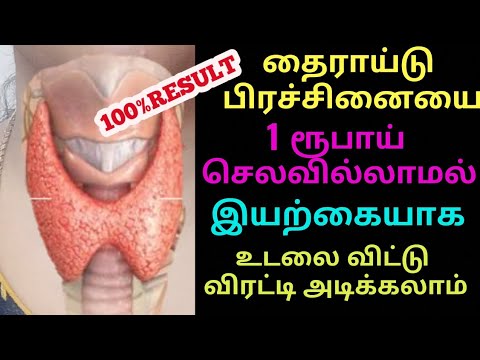 How To Cure Thyroid Naturally In Tamil | பெண்களின் தைராய்டு பிரச்சனை | விஸ்மய குடில்