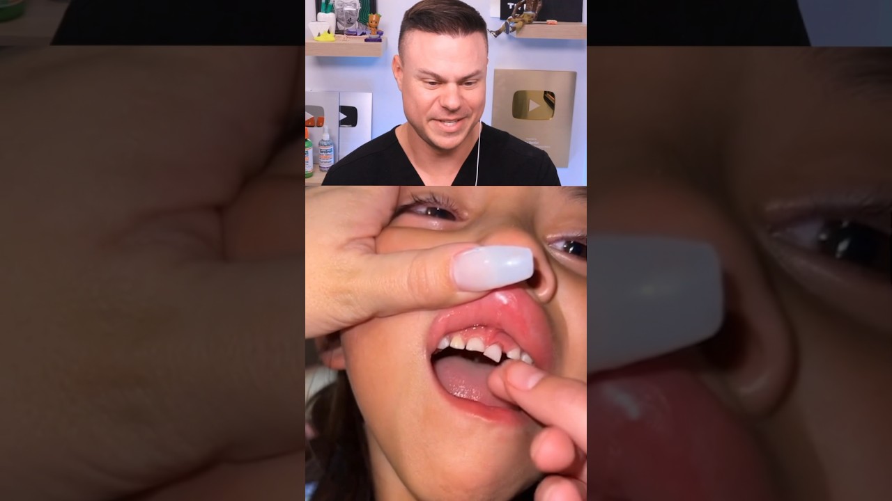 She RIPPED Her Tooth Out!