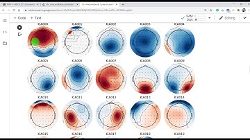 L8: MNE tutorial Part #1 - Load and Segment continuous EEG data