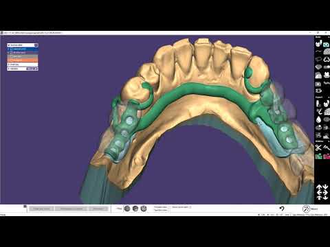 Video: Care era practica blockbusting-ului?