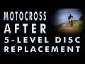 Riding Motocross after Disc Replacement Surgery at 5 Levels by ENANDE and Dr.. Ritter-Lang