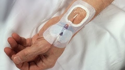 How to set up an Arterial Line