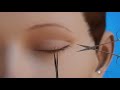 Surgery To Remove Lesions From The Eyelid Surgery To Remove Lesions From The Eyelid