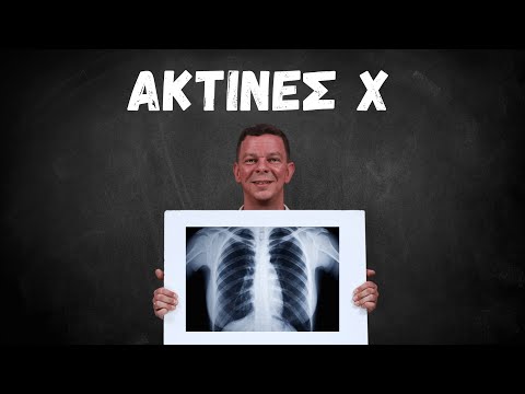 Ακτίνες Χ: Μια