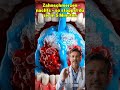 Zahnschmerzen nachts – so stoppst du sie in 5 Minuten #GesundLeben #FitnessFürMänner #DrJonasStein