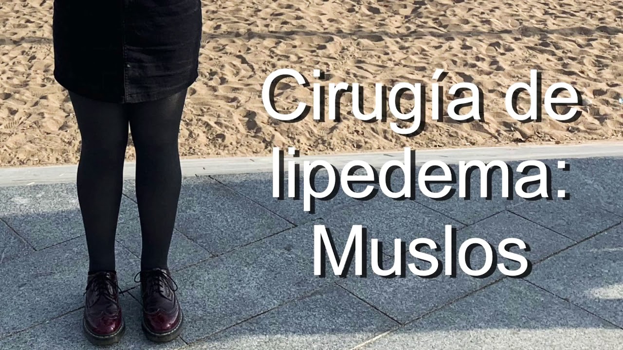 comida sana para adelgazar Cirugía de lipedema: muslos y fotos del progreso