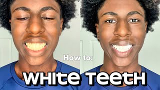 The Best Teeth Whitening Method That Actually Works At Home