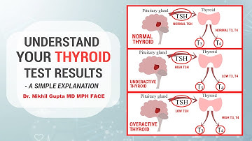 Hypothyroidism or Hyperthyroidism? Thyroid Function Test Results explained - Dr. Nikhil Gupta MD