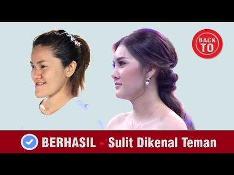 Video: 5 Operasi Plastik Paling Modis