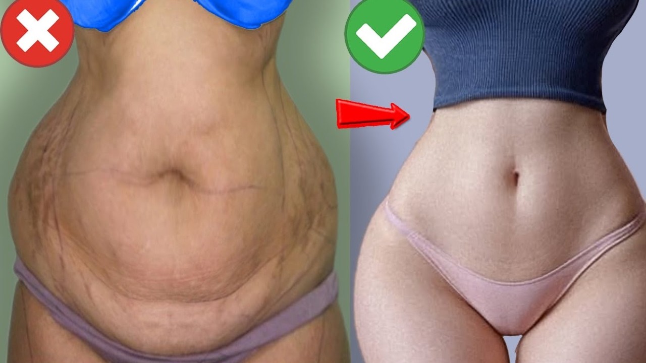 Tome isso de manhã e QUEIME a GORDURA da BARRIGA