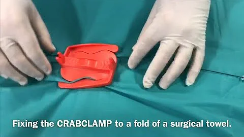 Fixing guidewires and catheters during endovascular procedures with CRABCLAMP