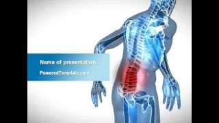 Lumbar Spine PowerPoint Template by PoweredTemplate.com