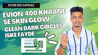 Evion 400 capsulekhaane se skin glow & clean dark circles or iske fayde #evion #evion400 #skinglow