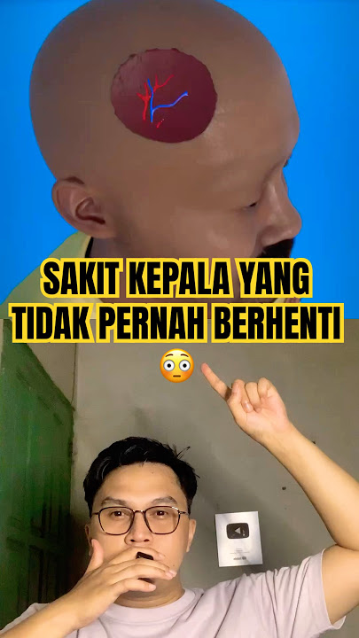 Download lagu Sakit kepala yang tidak berhenti😳 #science #neuroscience #doctor #thebaldheadnthedreadpodcast