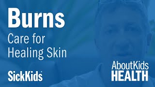 How to care for your child's healing skin after a burn / Soigner une brûlure en voie de guérison