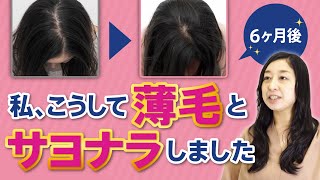 【体験談】女性の抜け毛・薄毛治療の真実