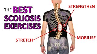 THE Best Exercises For Scoliosis Resimi