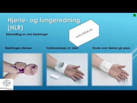 Video: Blødning: Årsaker, Akutte Symptomer, Førstehjelp Og Mer