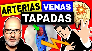 ¿Las personas obesas tienen las arterias obstruidas?