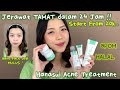 Obat Jerawat Ampuh Hanasui: Rahasia Kulit Bebas Jerawat