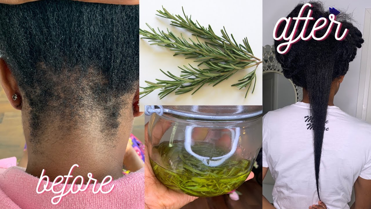 DIY ROSEMARY OIL AT HOME FOR EXTREME HAIR GROWTH/3 WAYS TO USE ROSEMARY