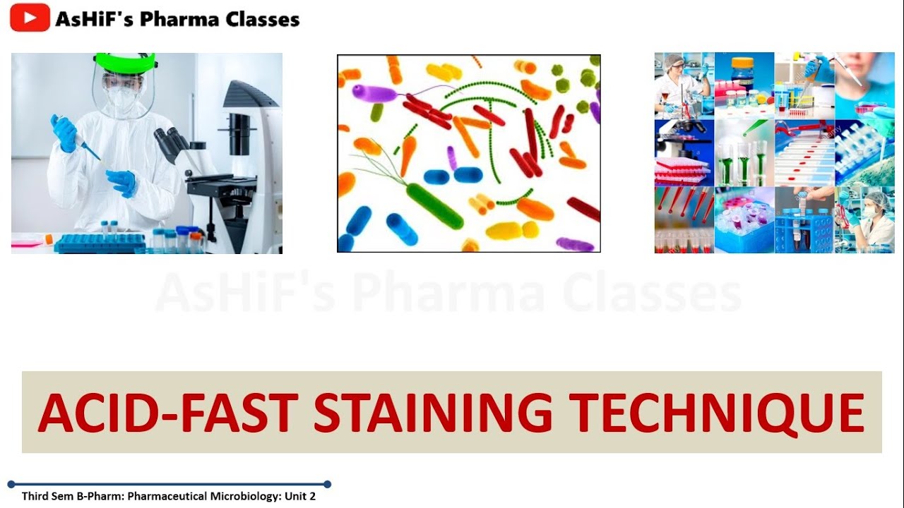 Identification of Bacteria Part 4: ACID-FAST STAINING TECHNIQUE: Principle, Reagents, Procedure