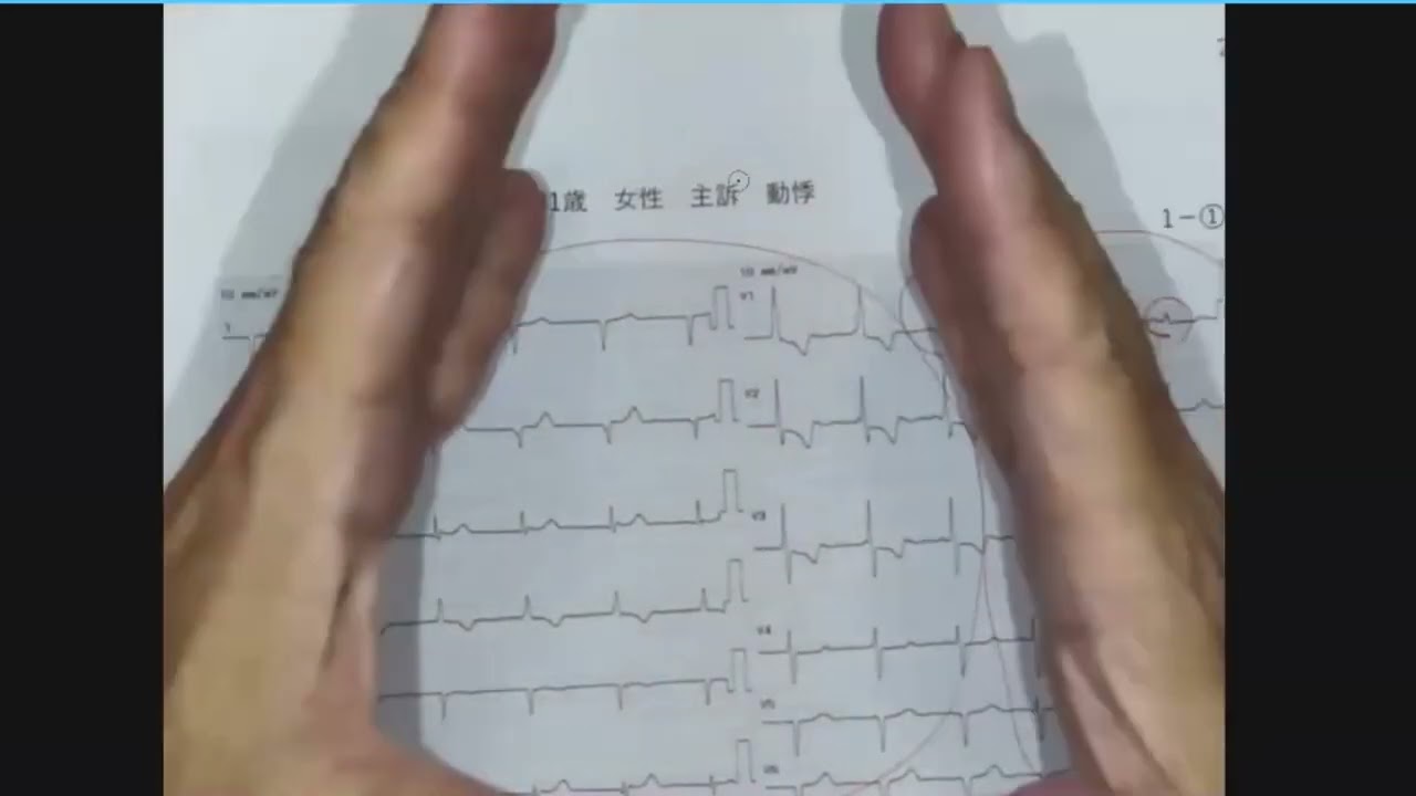 第39回　心電図・EPS　寺子屋