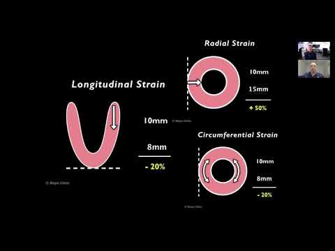 Video: Regionale Myocardiale Spanningsanalyse Via 2D Spikkels Tracking Echocardiografie: Validatie Met Sonomicrometrie En Correlatie Met Regionale Bloedstroom In Aanwezigheid Van Graduele