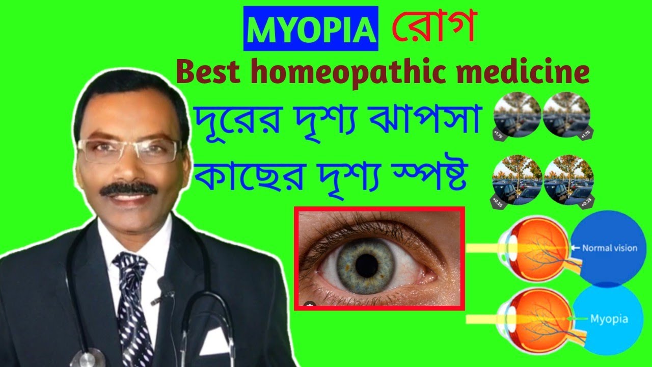 MYOPIA treatment in homeopathy চোখের দৃষ্টিশক্তি বাড়ানোর ঔষধ Dr