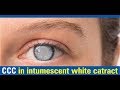 Ccc in intumescent white catract