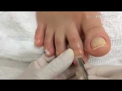 تعلم كيفية تنظيف أظافر القدم على اليوتيوب