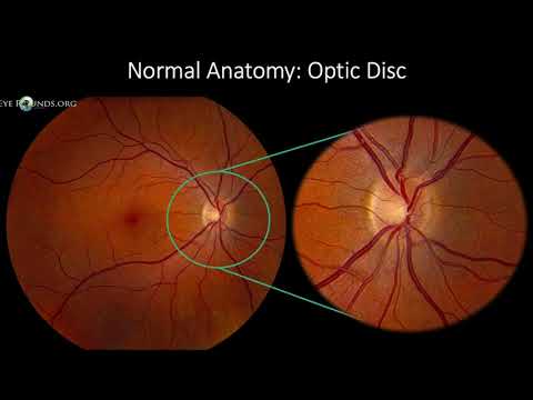 Fundus Photography Interpretation