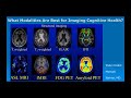 Brain Health and Imaging -  Dr. Cyrus Raji (June 2017)