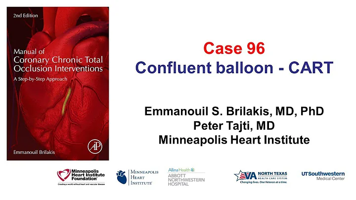 Case 96: Manual of CTO Interventions: Confluent balloon and CART technique