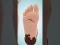 WHAT IS TETANUS? TETANUS KYA HAI ?
