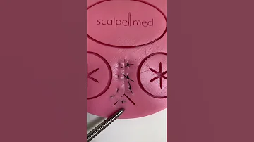 Ошибка при ушивании раны / Wound stitching error