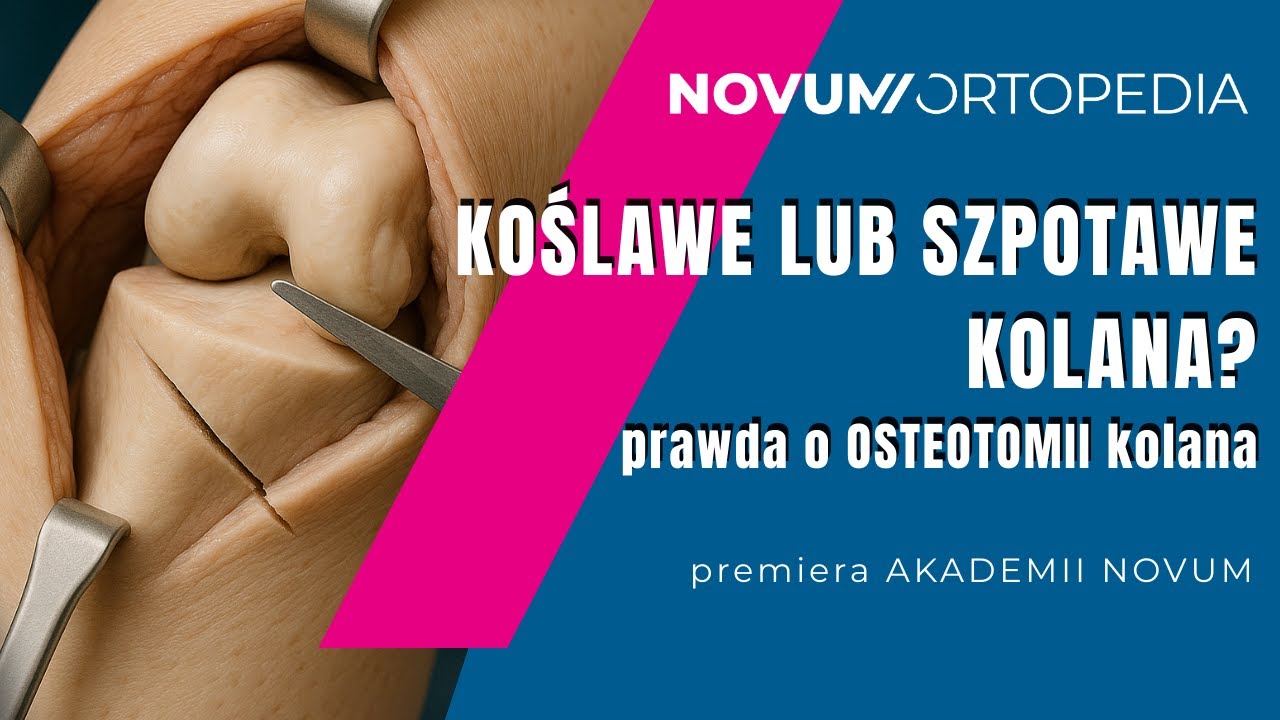 Osteotomia kolana 🦵 Jak leczymy koślawe/szpotawe kolana? I czy zawsze potrzebna jest osteotomia?