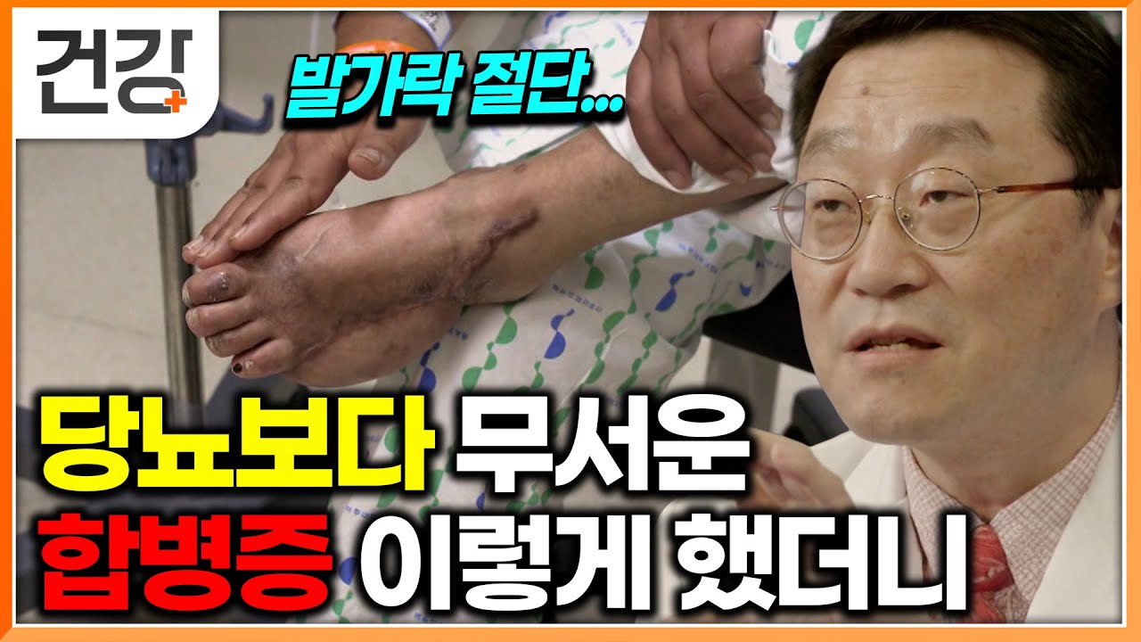 혈당관리가 꼭 필요하다, 당뇨 보다 무서운 합병증을 예방하기 위한 방법 알려드립니다｜명의｜#EBS건강