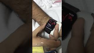 Apple Watch series 5 detect atrial fibrillation