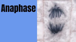 Anaphase-The third stage of mitosis