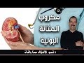 خطوات لعلاج التهاب المثانة من دون اللجوء إلى دواء