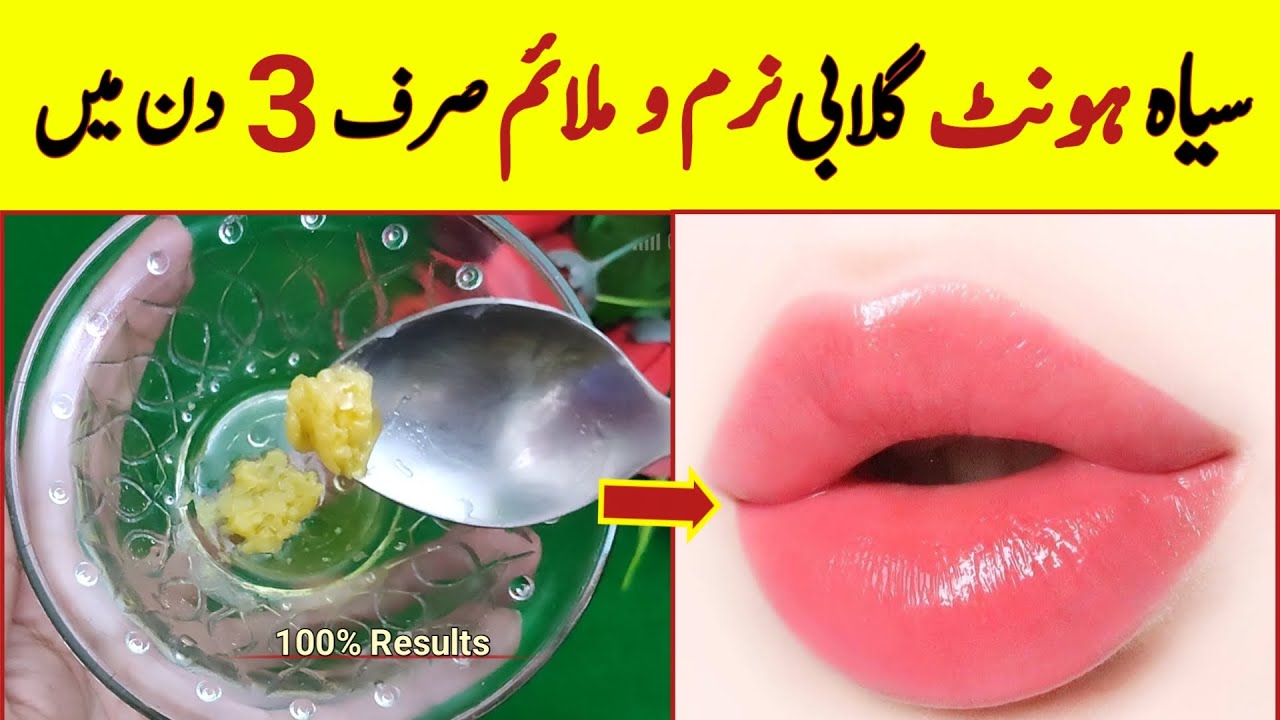 Get Soft Pink Lips Naturally Baby Pink Lips Get Rid Of Chapped Lips Dark To Pink Lips