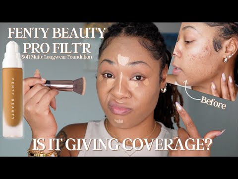 TRYING FENTY PRO FILTR SOFT MATTE FOUNDATION ON MY ACNE &amp; HYPERPIGMENTATION, IS IT GIVING COVERAGE?!