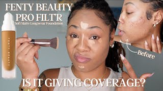 TRYING FENTY PRO FILTR SOFT MATTE FOUNDATION ON MY ACNE & HYPERPIGMENTATION, IS IT GIVING COVERAGE?! screenshot 5
