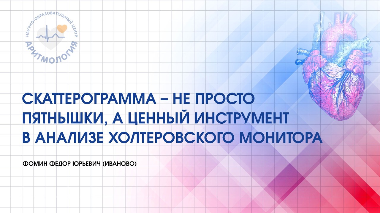 Скаттерограмма – не просто пятнышки, а ценный инструмент в анализе холтеровского монитора.