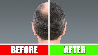 STOP Thinning Hair In Its Tracks! | Top Tips For Hair Loss, More Volume, &amp; Thin Hair #thinninghair