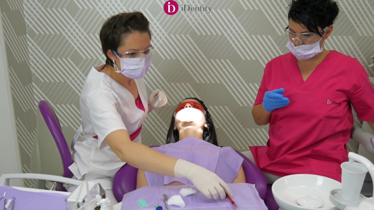 Albire dentara cu laser